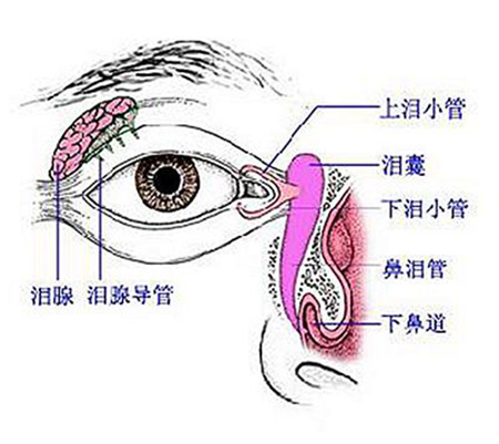 泪囊炎